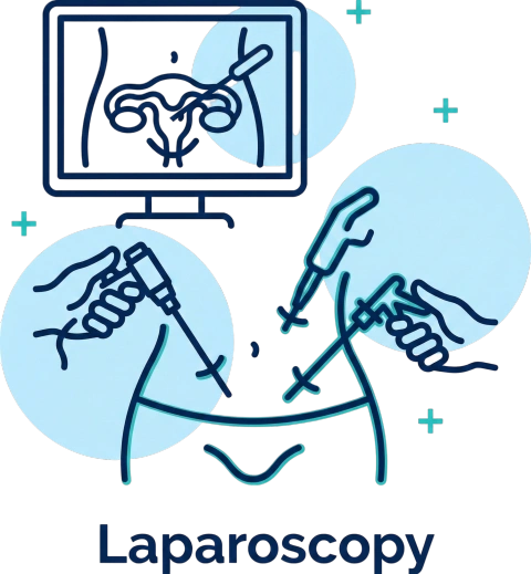 Laparoscopy Icon
